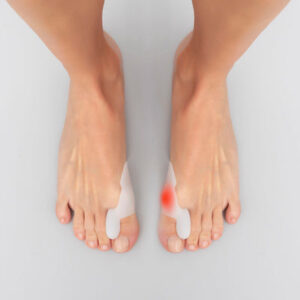Silicone Bunion Corrector Protector Bunilief InnovaGoods 2 Units
